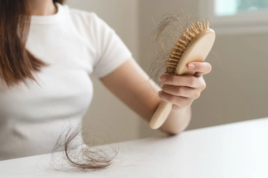 Nadměrné padání vlasů může být jedním z příznaků nedostatku vitamínu D, FOTO: Shutterstock - SportDeník Ženě padají vlasy