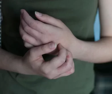 Škrábající se ruce s vyrážkou