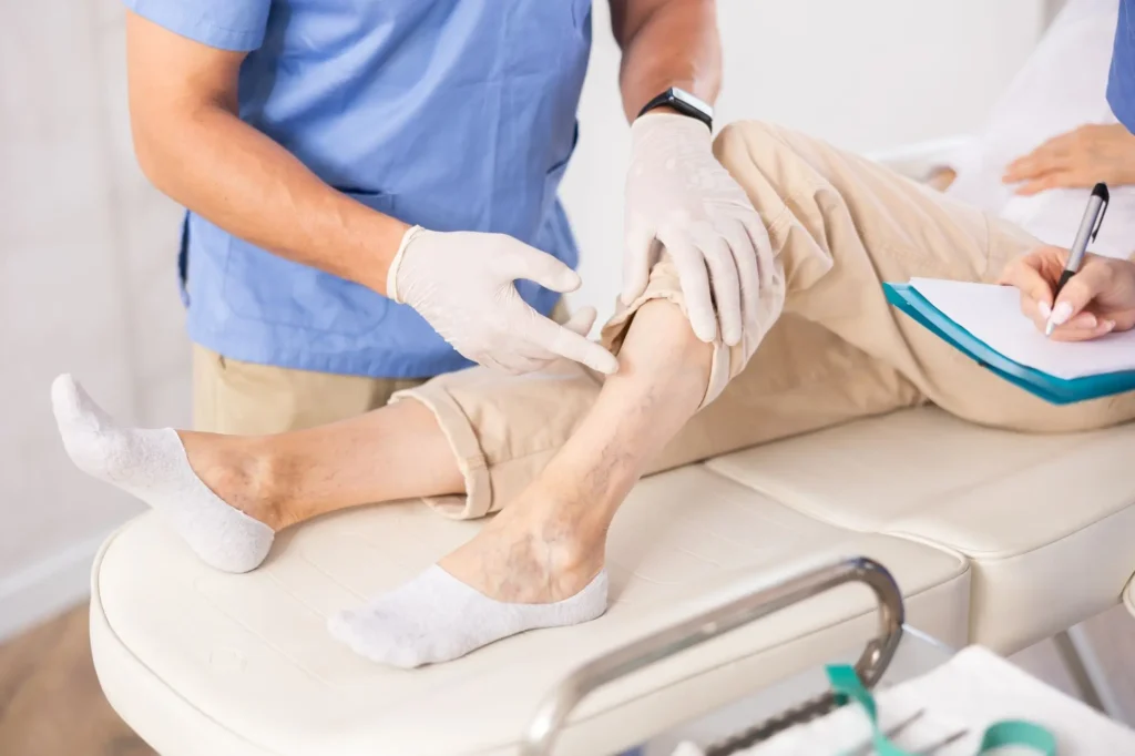 shutterstock_2455335803 - SportDeník žena s křečovými žilami na prohlídce u doktora