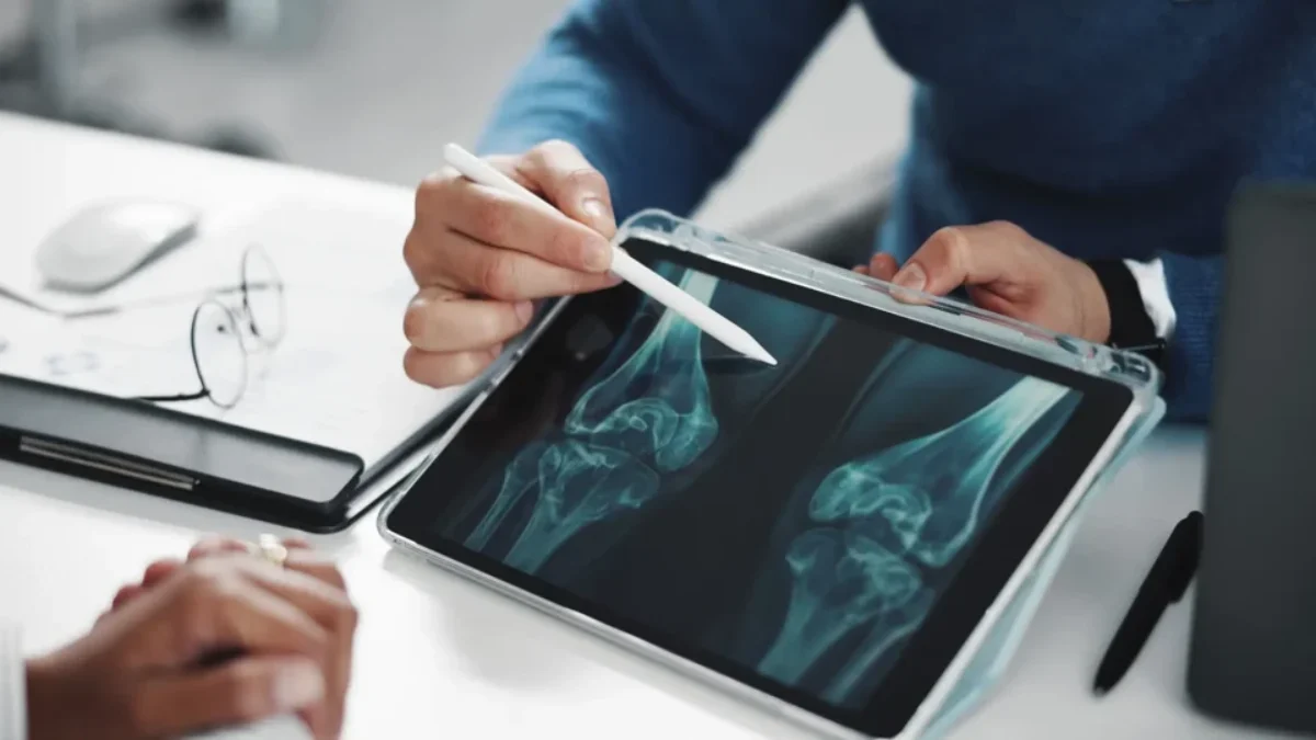 Osteoporóza neboli řídnutí kostí je chronické onemocnění kostry. Zdroj doktor vysvětluje osteoporozu