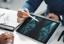 doktor vysvětluje osteoporozu