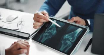 doktor vysvětluje osteoporozu