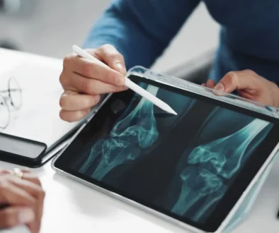 Osteoporóza neboli řídnutí kostí je chronické onemocnění kostry. Zdroj doktor vysvětluje osteoporozu