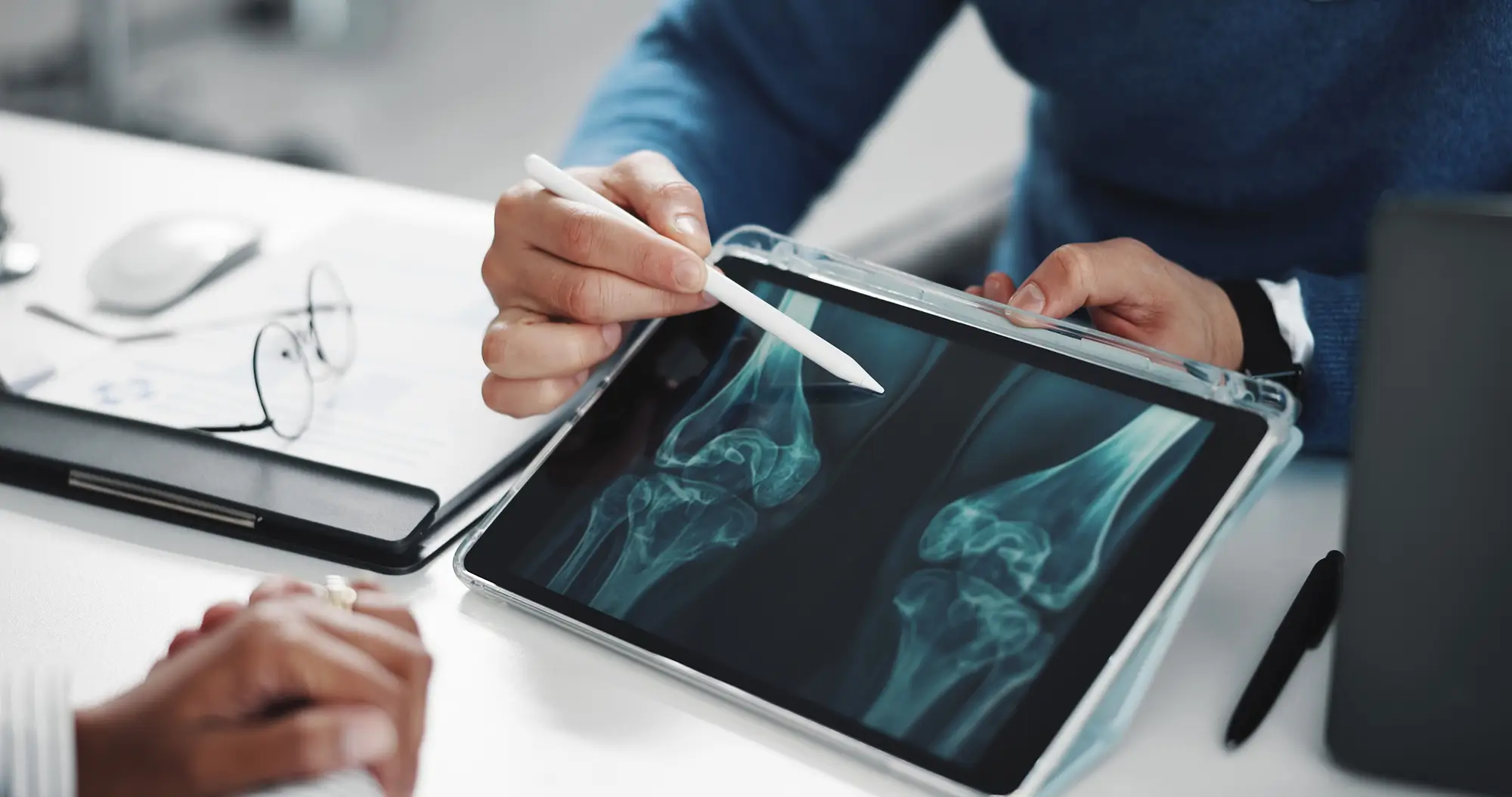 doktor vysvětluje osteoporozu