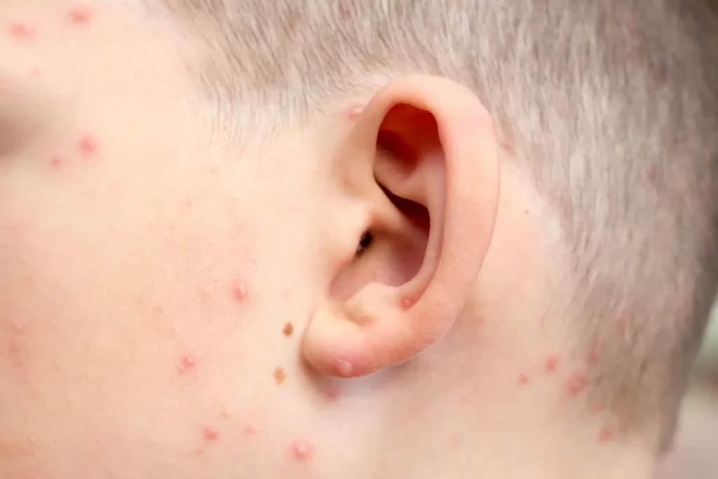 dětské ucho