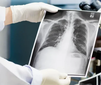 rentgenový snímek plic